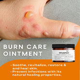 Burns Ointment, First Aid Wound Care, Cuts, Scars, Bruises, Bumps, Organic Healing Salve - Honey Lavender Magic Wholenest WholeNest 